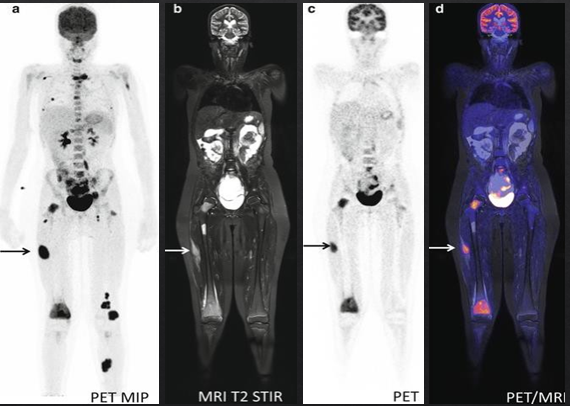 PET/MRI - MRC